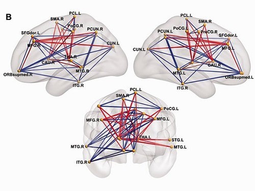 brain-1_500x375.jpg