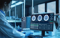 Ученые создали наночастицы, снабжающие клетки мозга кислородом после инсульта Ученые создали наночастицы, снабжающие клетки мозга кислородом после инсульта