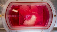 Ученые вырастили мини-печень из клеток кожи Ученые вырастили мини-печень из клеток кожи