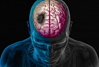 Ученые нашли гормон, замедляющий накопление токсичных бляшек в мозге людей с деменцией Ученые нашли гормон, замедляющий накопление токсичных бляшек в мозге людей с деменцией
