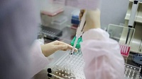 Ученые РФ разработали тест-систему, способную отличать вирусные инфекции от бактериальных Ученые РФ разработали тест-систему, способную отличать вирусные инфекции от бактериальных
