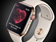 Часы Apple Watch поставили мужчине диагноз опасной аритмии сразу после включения Часы Apple Watch поставили мужчине диагноз опасной аритмии сразу после включения