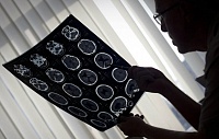 Ученые открыли область мозга, отвечающую за материнские защитные инстинкты Ученые открыли область мозга, отвечающую за материнские защитные инстинкты