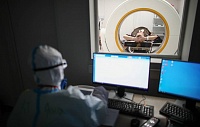 Коронавирус вызывает нарушения в работе мозга у примерно половины пациентов Коронавирус вызывает нарушения в работе мозга у примерно половины пациентов