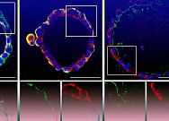 Ученые создали биологическую модель легких для изучения коронавирусной инфекции Ученые создали биологическую модель легких для изучения коронавирусной инфекции
