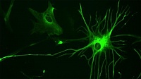 Ученые нашли, где в организме ВИЧ скрывается от лечения Ученые нашли, где в организме ВИЧ скрывается от лечения