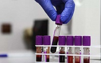 Создан тест, выявляющий по крови рак за четыре года до его проявления Создан тест, выявляющий по крови рак за четыре года до его проявления