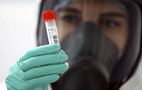 Ученые создали прибор для обнаружения коронавируса за 10 секунд Ученые создали прибор для обнаружения коронавируса за 10 секунд