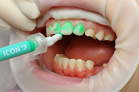 ������������ ����������� ����� ���������� ������� ������� ��� ���������