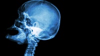 Ученые нашли гены, управляющие размерами черепа человека Ученые нашли гены, управляющие размерами черепа человека