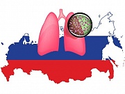 Исследователи предсказали России много устойчивого туберкулеза к 2040 году Исследователи предсказали России много устойчивого туберкулеза к 2040 году