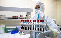 Исчезновение антител к коронавирусу из крови переболевших засекли на третий месяц Исчезновение антител к коронавирусу из крови переболевших засекли на третий месяц