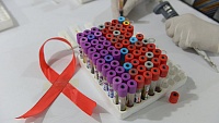 Ученые получили антитела, убивающие 99% штаммов ВИЧ Ученые получили антитела, убивающие 99% штаммов ВИЧ