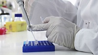 Разработка российских химиков поможет уменьшить процент отторжения имплантатов Разработка российских химиков поможет уменьшить процент отторжения имплантатов