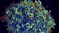 Иммунотерапия ВИЧ прошла первую фазу клинических испытаний Иммунотерапия ВИЧ прошла первую фазу клинических испытаний