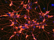 Способность нейронов к обучению связали с их метаболизмом Способность нейронов к обучению связали с их метаболизмом