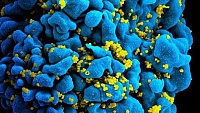Ученые создали иммунные клетки, способные бороться с ВИЧ Ученые создали иммунные клетки, способные бороться с ВИЧ