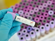 Врачам впервые в мире удалось вылечить пациента с ВИЧ Врачам впервые в мире удалось вылечить пациента с ВИЧ